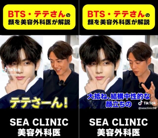 BTS V、日本の形成外科専門医も認める「可愛さ＋ハンサムさの調和、国宝級の美男」
