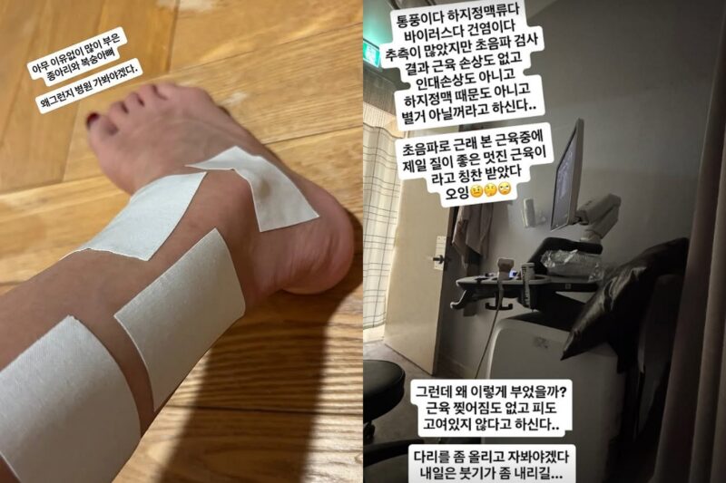 ユン・ジョンシン♥」チョン・ミラ、健康悪化...原因も分からず