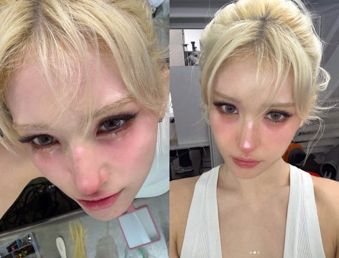 チョン・ソミ、高級アクセサリーを紛失して落胆