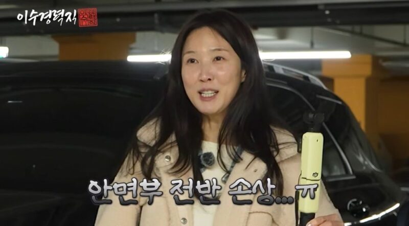 イ・スギョン、交通事故に遭い「顔面全体損傷→全治8週間」と診断
