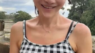 エルプラン、日差しで赤くなった肌を公開…「シミは蓄積するもの」ケア法を共有