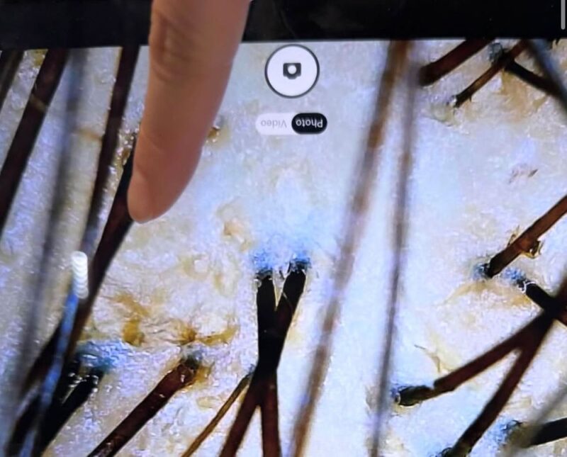 「離婚2回→美容師転身」女性タレント、頭皮の状態に絶望→「気絶しそうだった」