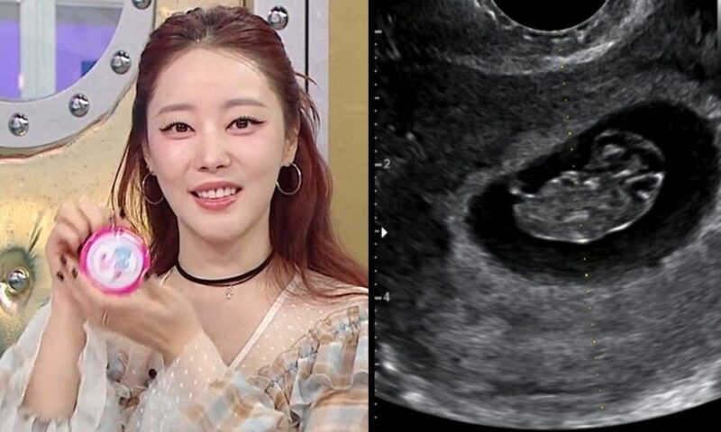 高ユリ、妊娠11週目でも美貌のピーク…変わらぬVライン→頬肉消失