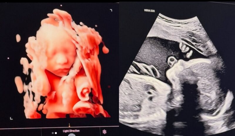 芸能界引退→アメリカへ…FTISLAND出身ソン・スンヒョン、2年ぶりにパパに