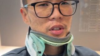「ショミ」出身ウディ・ゴチャイルド、屋上から転落→治療後の心境…「本当に運が良かった」