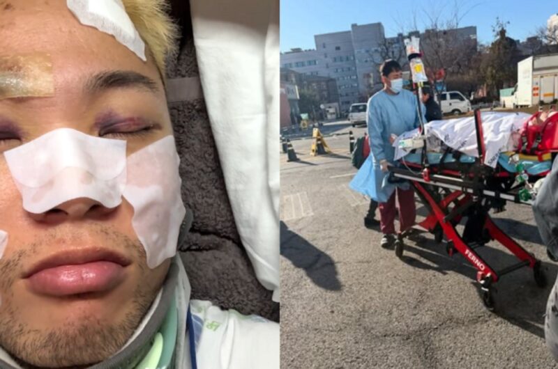 「ショミ」出身ウディ・ゴチャイルド、屋上から転落→治療後の心境…「本当に運が良かった」