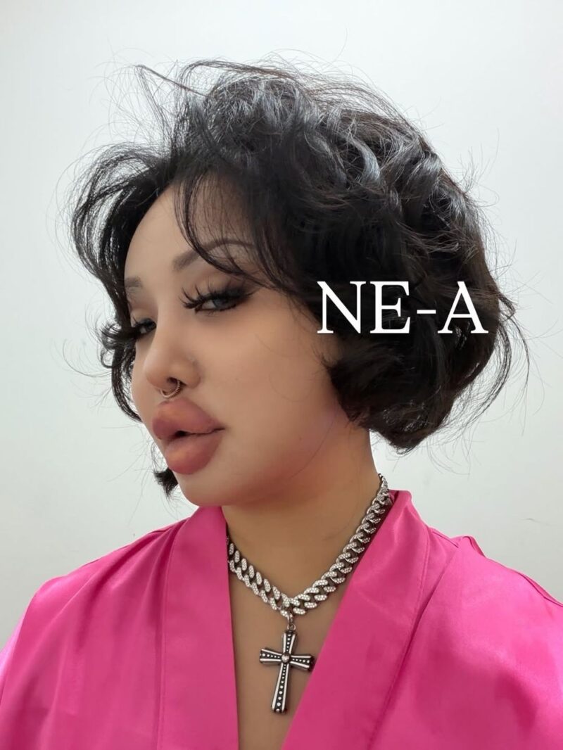 衝撃！ララル、鼻手術・目下脂肪→今度はフィラー副作用？「唇＝顔の半分」