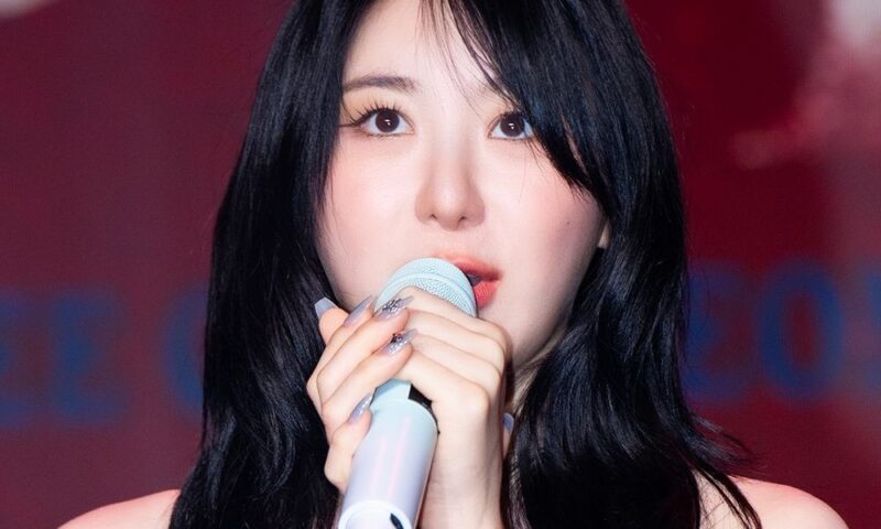 「抜け毛説」イ・チェヨン、大金かけて「3570本」植毛…「生え際がスカスカ」