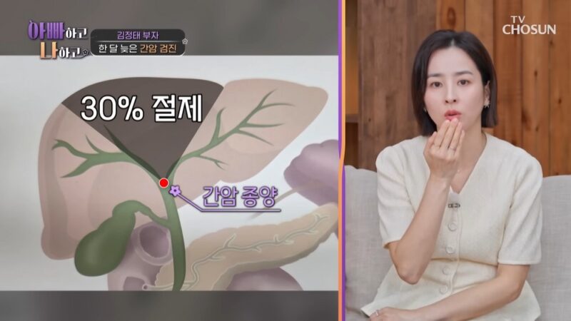 「癌闘病」キム・ジョンテ、肝臓30%切除も生涯「完治不可能」…「母系遺伝の保因者」（『パパと3人』）