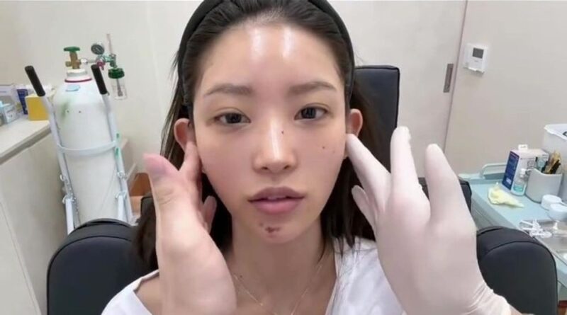 チェ・ジュンヒ、「輪郭+目切開」→結婚式まで7日でまた施術…“ラストスパート”