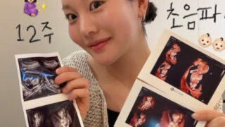 キム・チェヨン、双子のエコー写真を公開「性別判明待ち」と喜びの報告