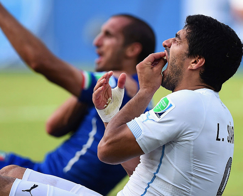 W杯の衝撃3大事件 「神の手」「頭突き」「噛みつき」の仰天ハットトリック