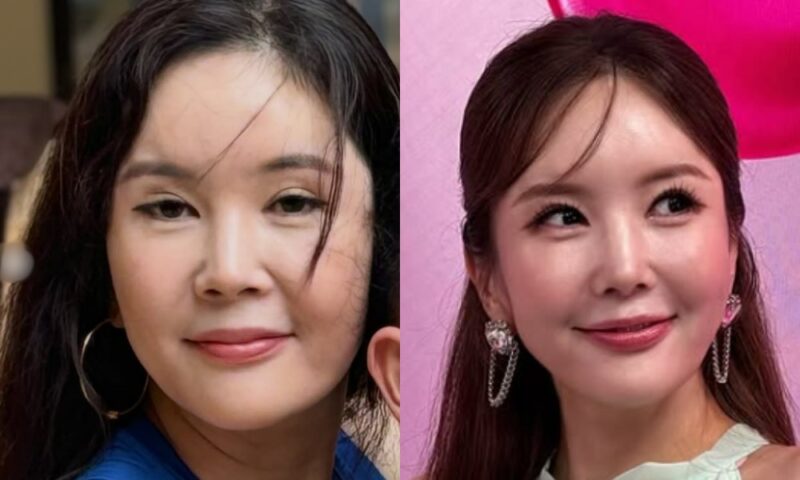 チャン・ヨンラン、過去写真公開で“自己肯定感アップ”―ユーモアと整形トークで注目集める