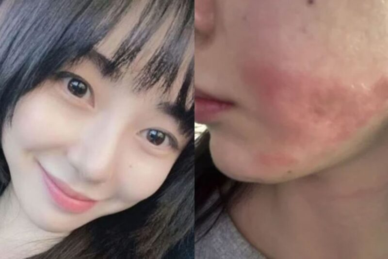 医療事故被害のクォン・ミナ、和解提案も虚しく返ってきたのは逆訴訟…「正直、すごく怖い」