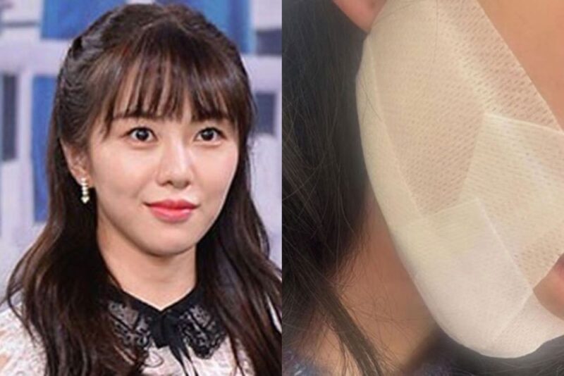 医療事故被害のクォン・ミナ、和解提案も虚しく返ってきたのは逆訴訟…「正直、すごく怖い」