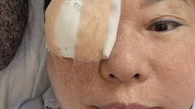 ヤン・ヒウン、角膜移植手術→放射線治療後の嬉しい知らせ…"たくましく克服"