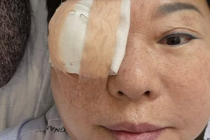 양희은, 각막 이식 수술→방사선 치료 후 반가운 소식…”씩씩하게 극복”