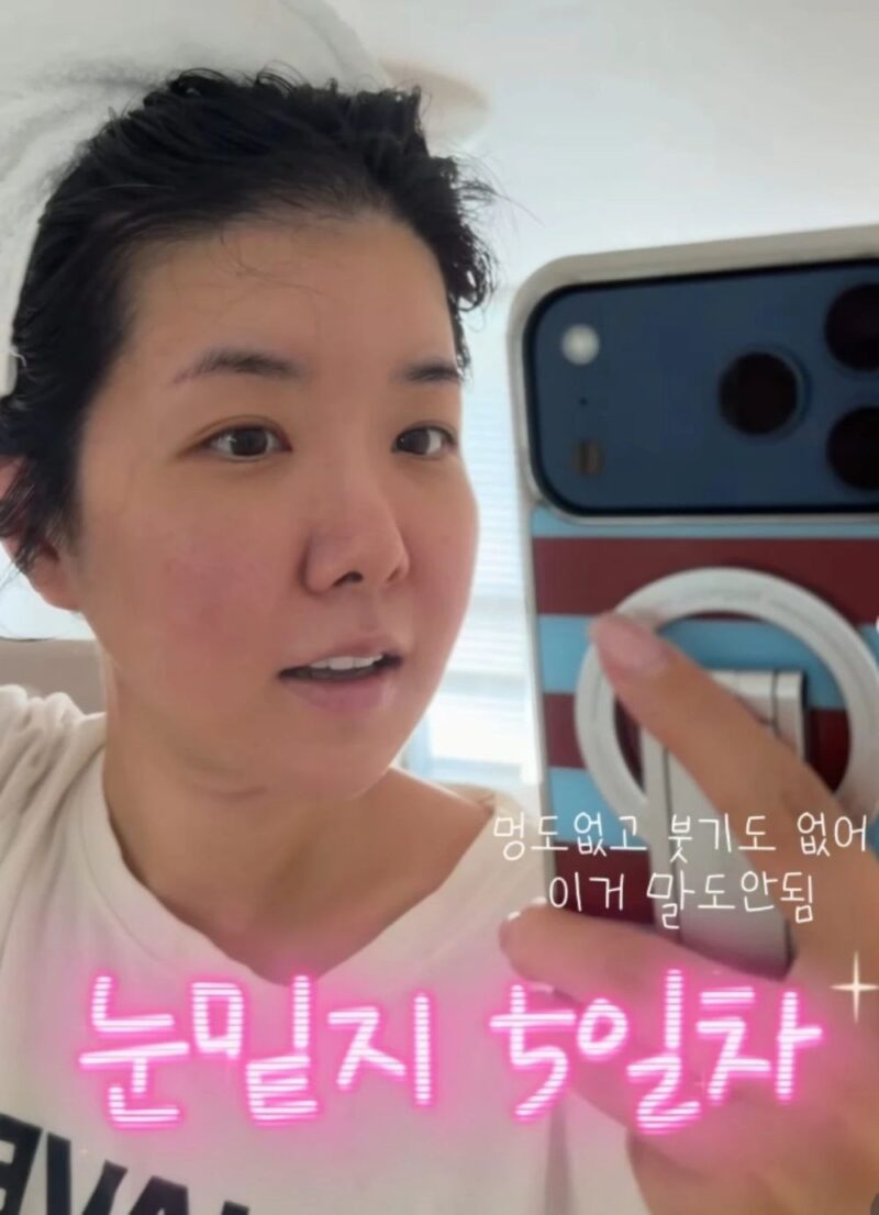 「双子ママ」キム・ジヘ、10年ぶり整形告白→手術5日目の顔公開「可愛ぶらない」
