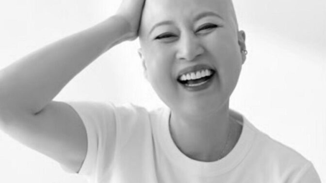 「闘病中」パク・ミソン、衝撃の近況…「真っ黒に変色した爪」に心配の声