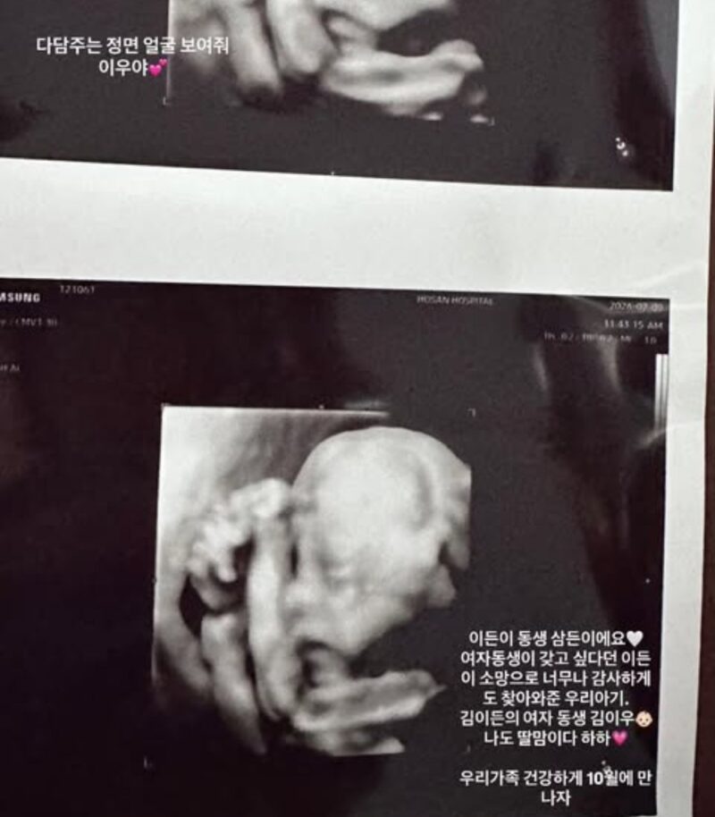 G-DRAGON、2人目のおいっ子が誕生へ…キム・ミンジョン♥クォン・ダミ、女児妊娠→10月出産発表