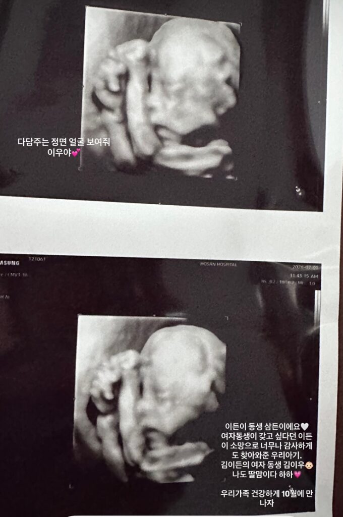 G-DRAGONに姪っ子が誕生へ…クォン・ダミ&キム・ミンジュン夫妻、第2子妊娠を発表