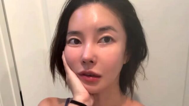 37歳キム・ユンジ、施術2ヶ月で激変した顔をビフォーアフター公開