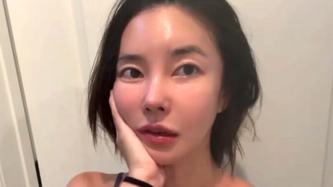 37歳キム・ユンジ、施術2ヶ月で激変した顔をビフォーアフター公開