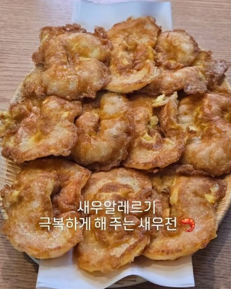 シン・ギル、母の悲報で食事断つも4ヶ月ぶりに味覚回復「アレルギーも改善した」
