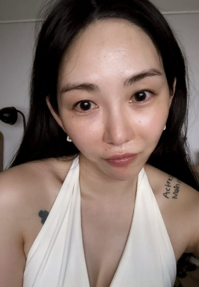 クォン・ミナ、医療事故被害→激変した顔にファンも驚愕…「ちょっと綺麗ぶろうとしたら」