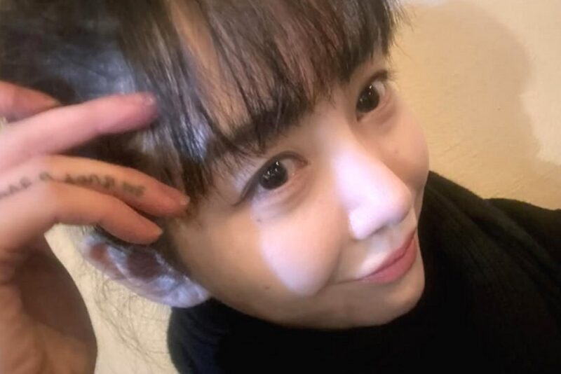 クォン・ミナ、医療事故被害→激変した顔にファンも驚愕…「ちょっと綺麗ぶろうとしたら」