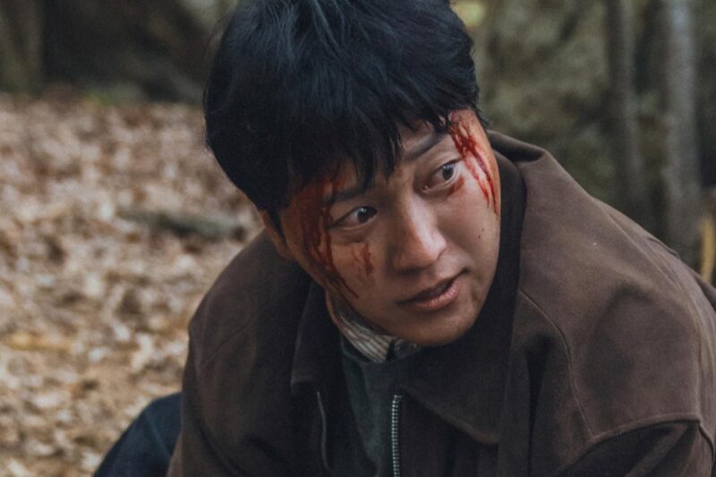 キム・デミョン、衝撃の「血まみれ」姿…写真拡散でファン騒然