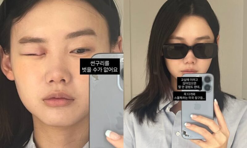 「検事♥」最年少女性アナウンサー、目がパンパンに腫れたまま…「サングラス外せない」