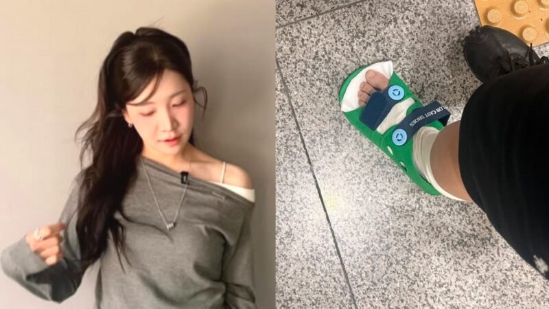 「既婚男性に公開告白」の女芸人キム・ジユ、済州島旅行先での“足ギプス”姿にファン心配の声