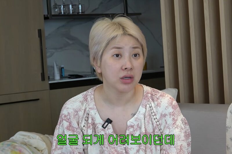 서인영, ‘성형’ 솔직 고백→코 수술만 다섯 번…”방송마다 달라, ‘우결’ 코는 따로” 