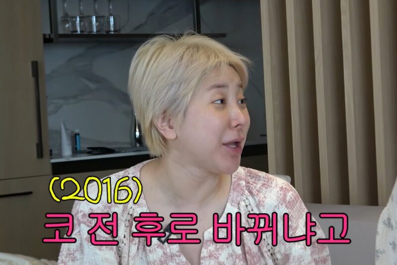 서인영, ‘성형’ 솔직 고백→코 수술만 다섯 번…”방송마다 달라, ‘우결’ 코는 따로” 
