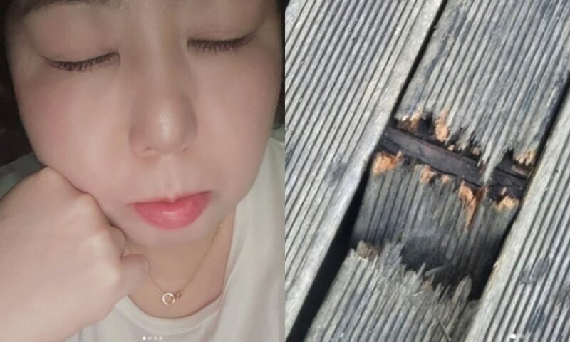‘120kg’ 신기루, 몸무게 못 버텼나…야외서 사고 발생→”가시 빼느라 애먹어” 