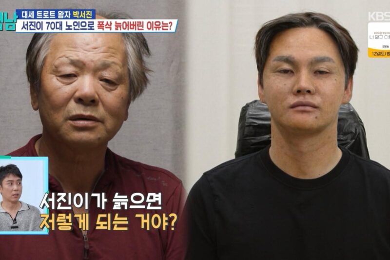 パク・ソジン、また顔が変わった?衝撃のビフォーアフター写真が話題に