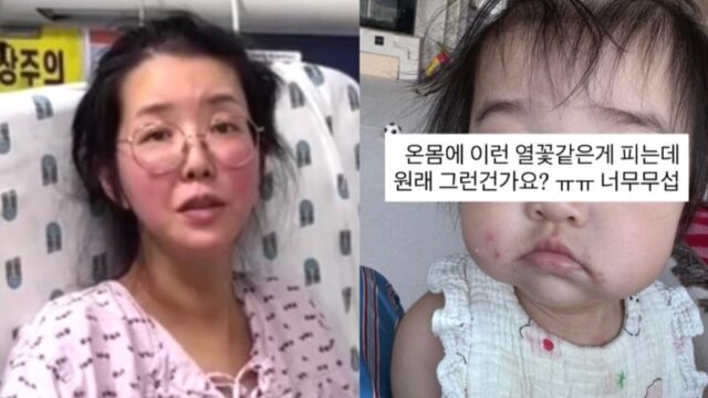 双子ママのキム・ジヘ、予防接種後の発熱と発疹に困惑　フォロワーのアドバイスで病院へ