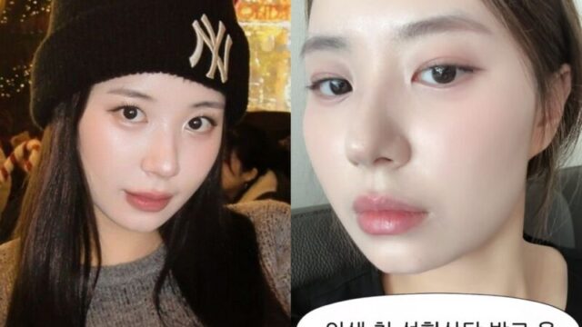 チェ・ヒョンソクシェフの娘チョ・ヨンス、出産後の外見の変化で初の形成外科相談へ