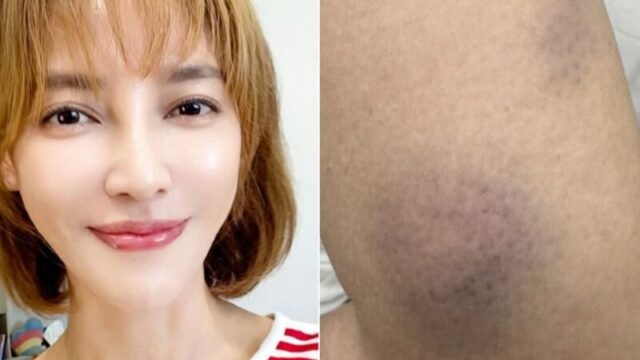 台湾の人気女優リー・ペイリン、元夫からの暴行を警察へ告訴　診断書を取得するも心身へのダメージ深刻