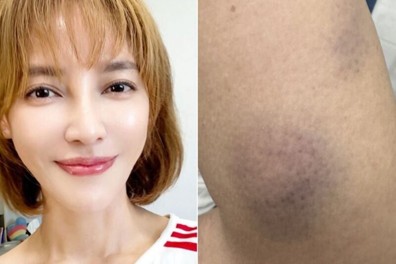 台湾の人気女優リー・ペイリン、元夫からの暴行を警察へ告訴　診断書を取得するも心身へのダメージ深刻