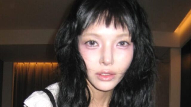 元AOAジミン、転倒事故から半年で再び病院へ…心身の不調と過酷な現状を明かす