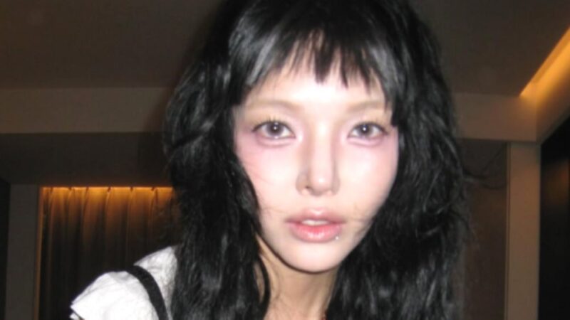 元AOAジミン、転倒事故から半年で再び病院へ…心身の不調と過酷な現状を明かす